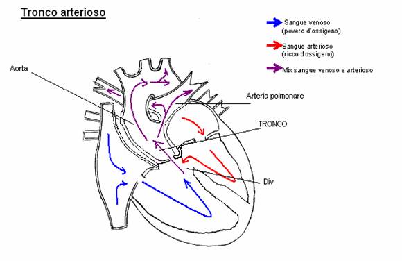 Tronco Arterioso